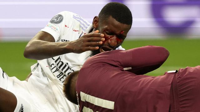 Rüdiger tras sufrir un aparatoso golpe en el partido ante el Shakhtar Donetsk