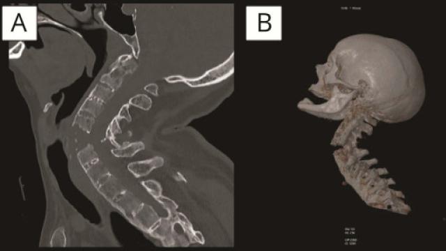 Imagen radiográfica perteneciente al estudio.