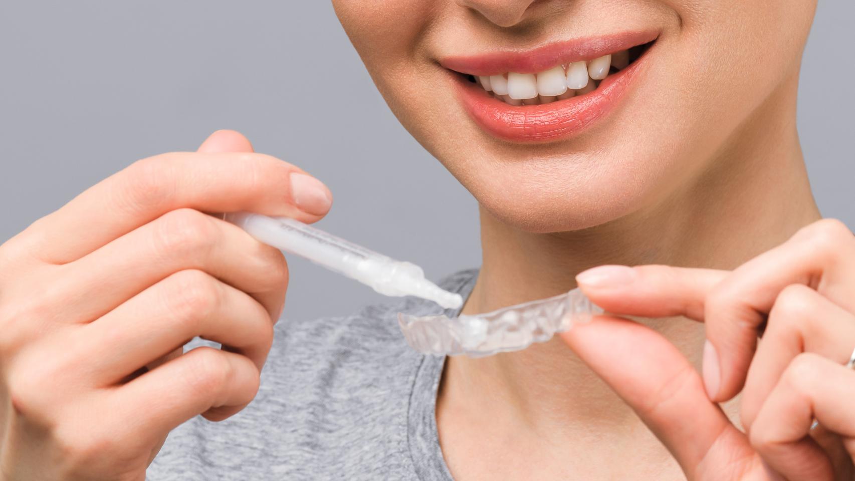 Los 5mejores kits para hacer un blanqueamiento dental en casa