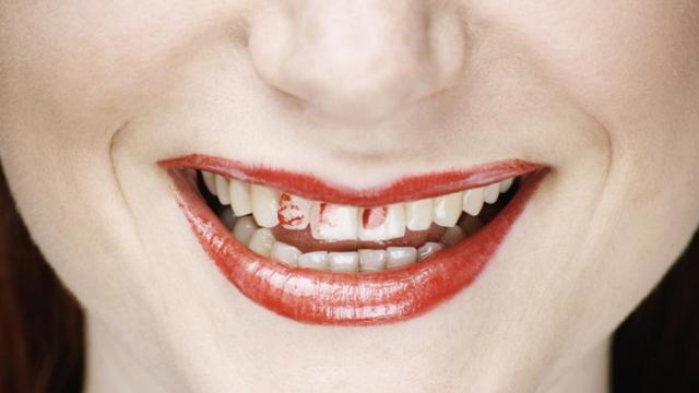 El truco para que no se manchen los dientes de labial.