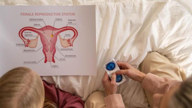 Fotografía de archivo de cáncer de cérvix.