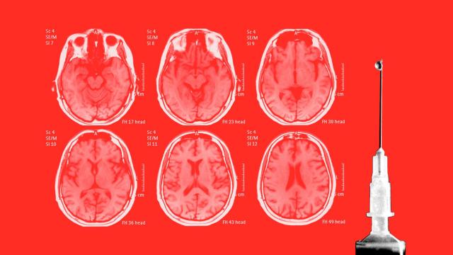 La esperanza de un cribado poblacional de la enfermedad da un paso adelante con este hallazgo.