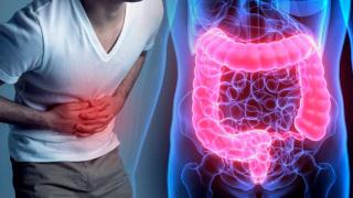 Estos son los 9 sencillos hábitos que evitan la inflamación intestinal y recomiendan los médicos