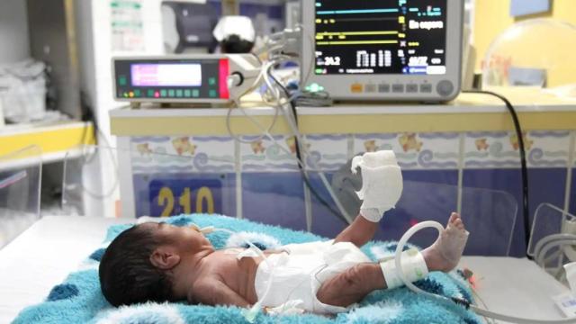 Imagen de archivo de un bebé prematuro en una incubadora.