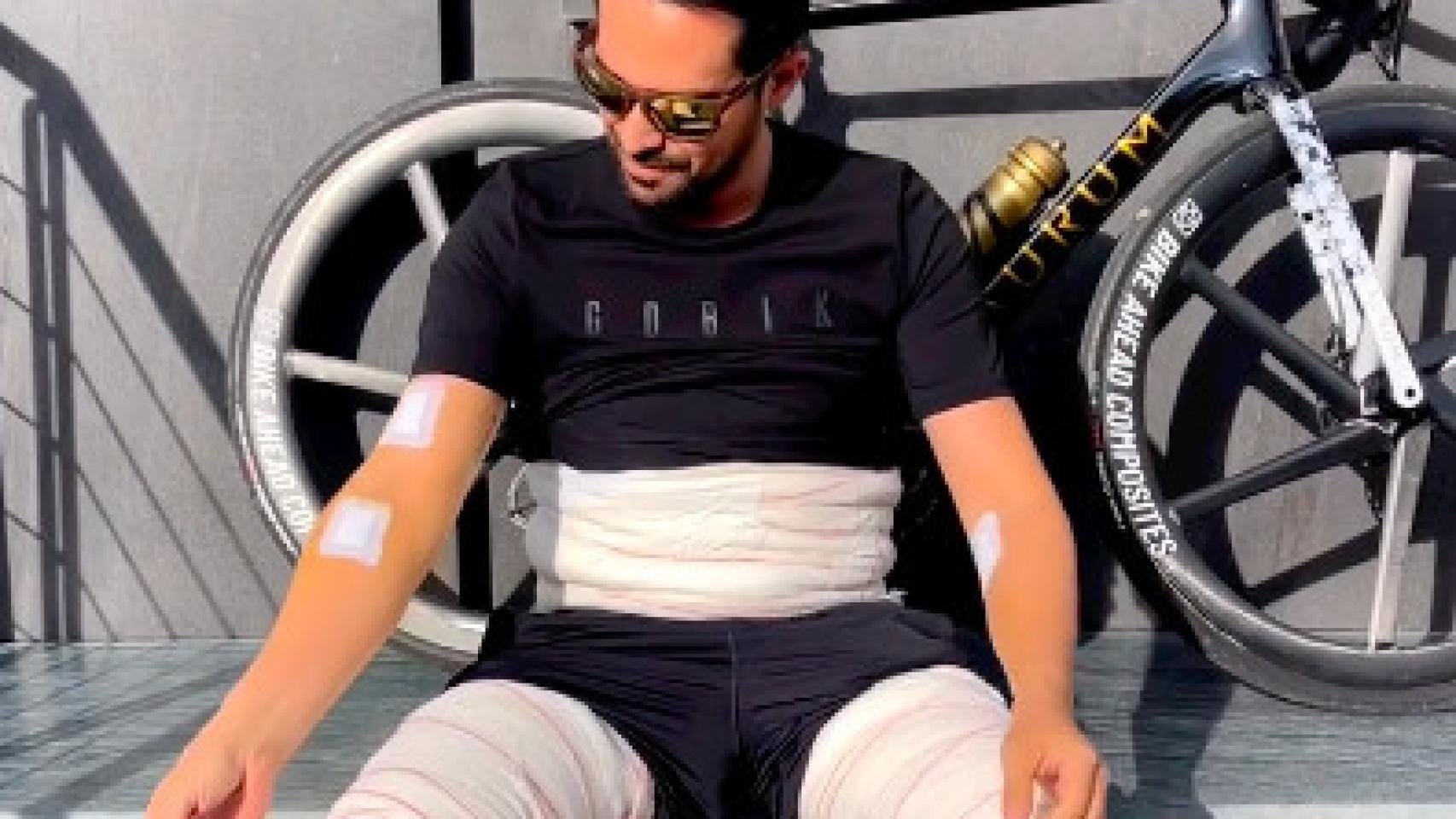 Alberto Contador lleno de vendas tras una operación
