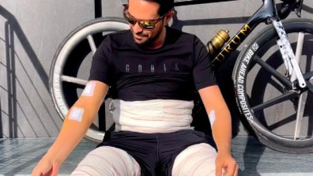 Alberto Contador lleno de vendas tras una operación