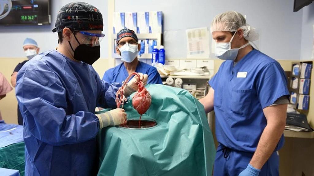Miembros del equipo de la operación de David Bennett preparan el corazón de cerdo.