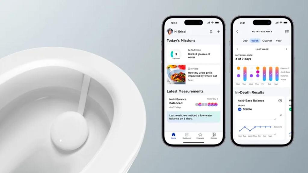 U-Scan de Withings