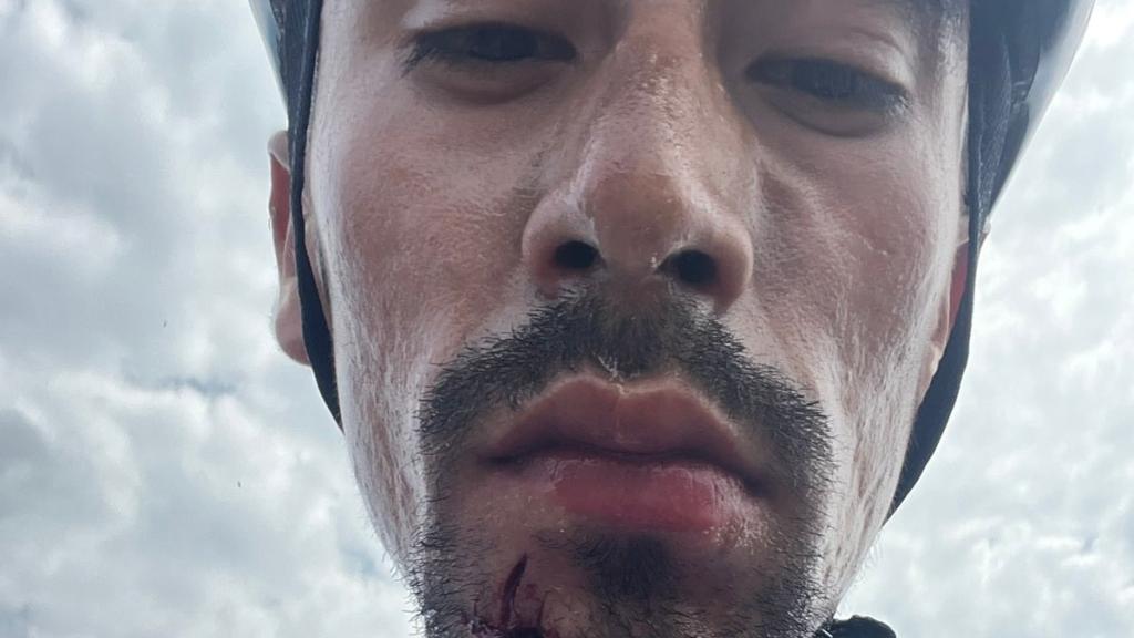 Iván Ramiro Sosa, ciclista de Movistar Team, tras recibir una agresión