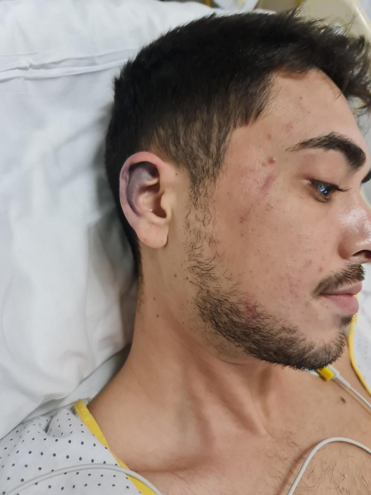 Antonio tenía completamente morada una oreja, a causa de los puñetazos y de las patadas que recibió.