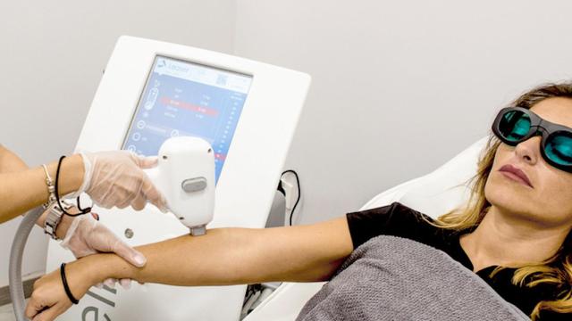 Una depilación láser.