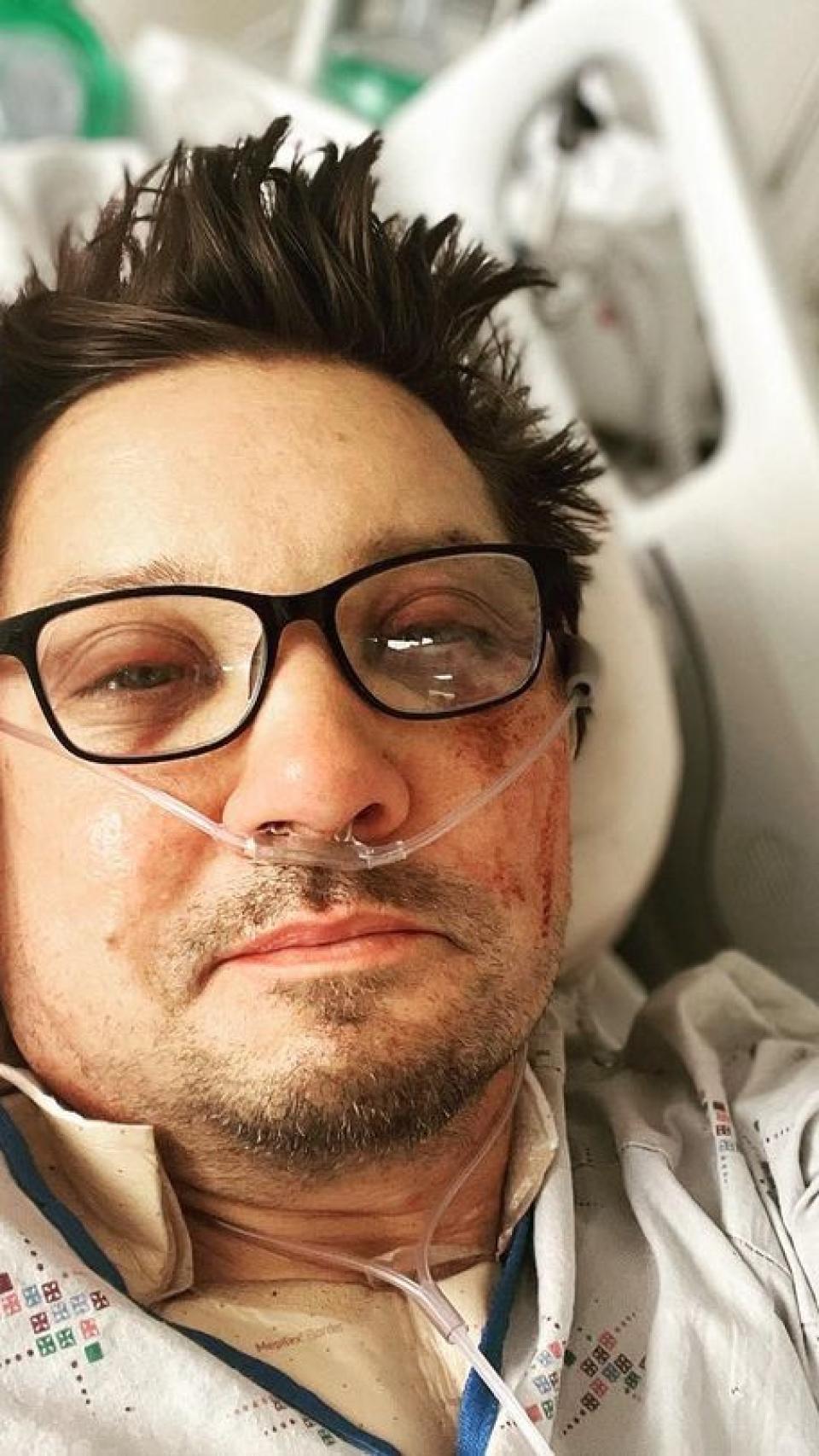 La imagen que el propio Renner compartió en sus redes tras el accidente.
