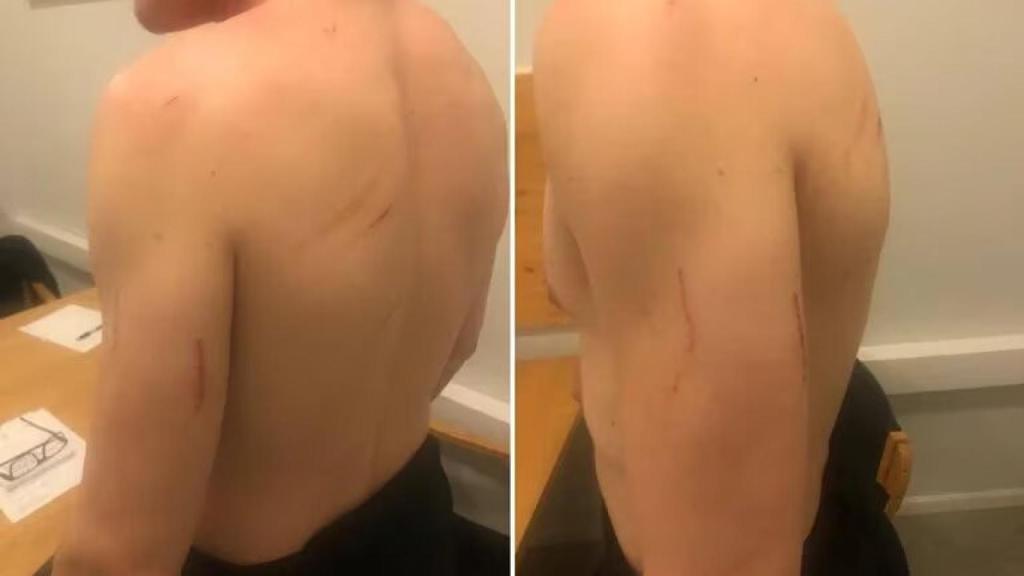 Imágenes compartidas por el abogado de Medvédev tras cruzar la frontera.