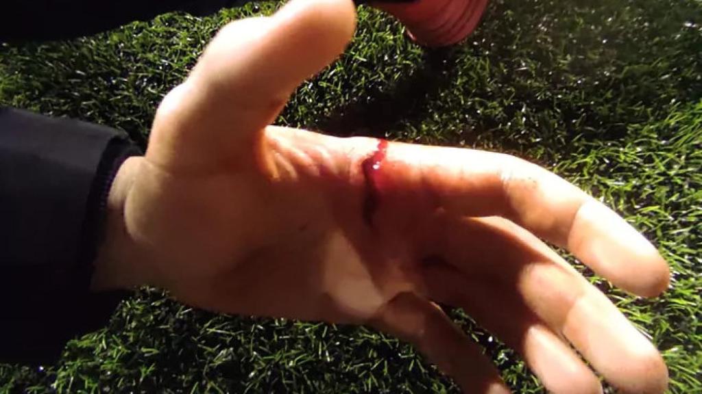 La mano del entrenador del CD Figras
