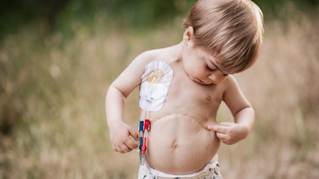 Mateo, en una imagen de @inmariosfotografia, mostrando la cicatriz del trasplante de hígado que se le realizó por la mutación del gen NEK8.
