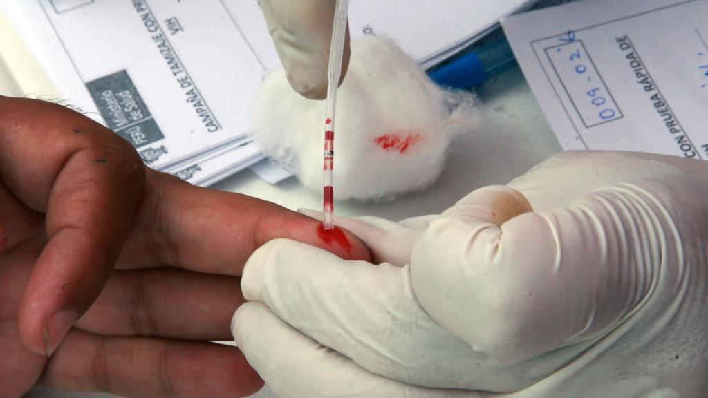 Test de VIH a partir de la gota de sangre de un paciente.