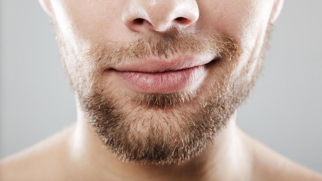 Los labios cortados se ven mucho en invierno.