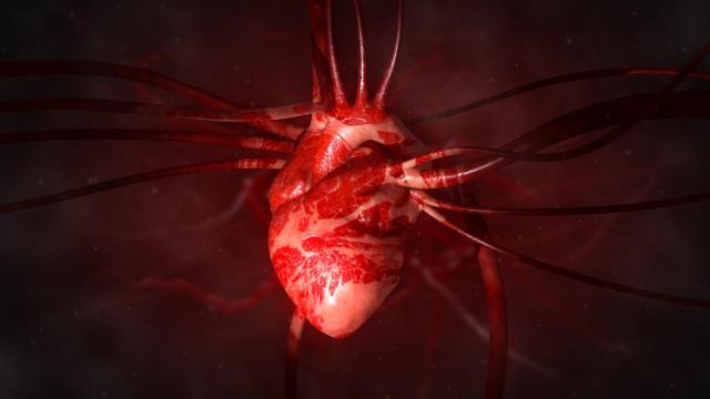 La falta de sueño se ha relacionado con un mayor riesgo de infarto.