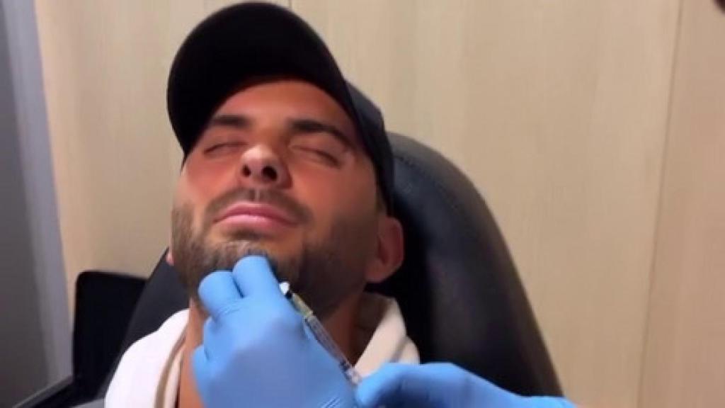 Suso Álvarez durante su tratamiento para la alopecia en una imagen de sus redes sociales.