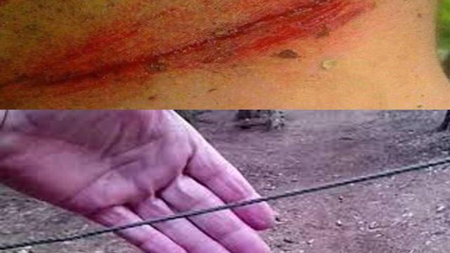 Heridas y cables similares a los aparecidos en Sanabria