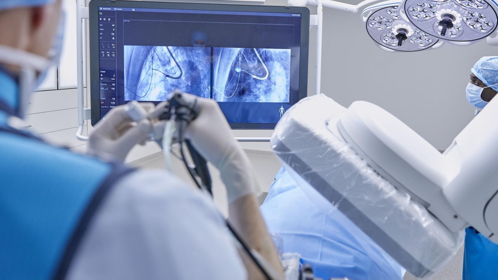 Diagnosticando el cáncer de pulmón. Philips Azurion/EP.