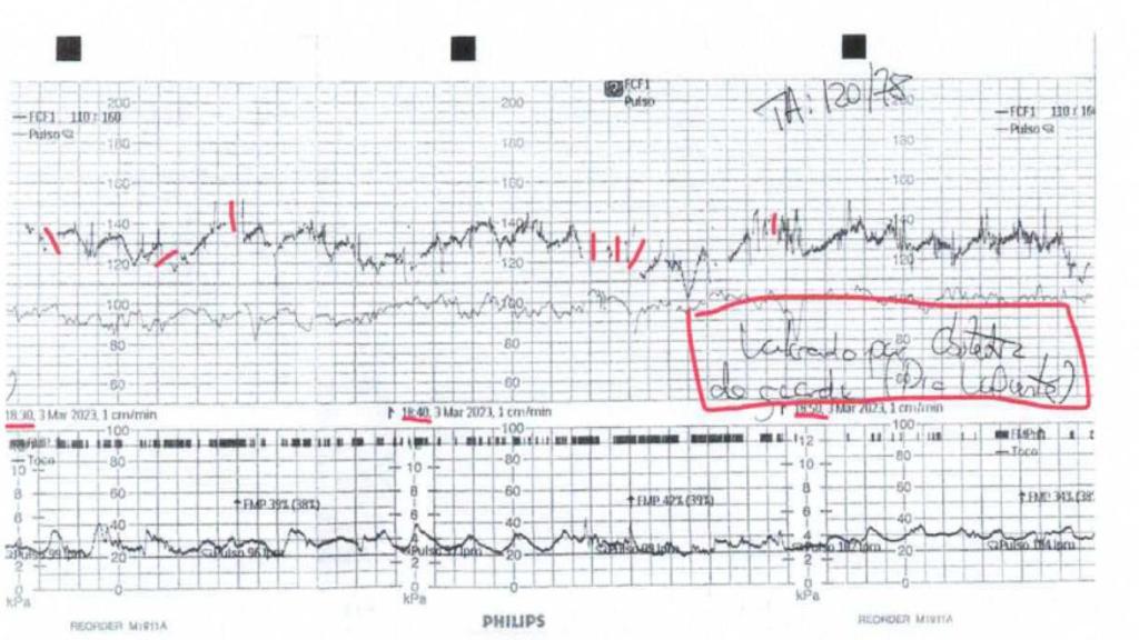 Una captura de las gráficas de monitorización fetal, con anotaciones manuscritas por personal sanitario, donde se refleja que han consultado con la ginecóloga supuestas ausencias de latidos en el corazón de la bebé que esperaba Ana.