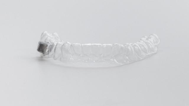 El sensor colocado en la dentadura.