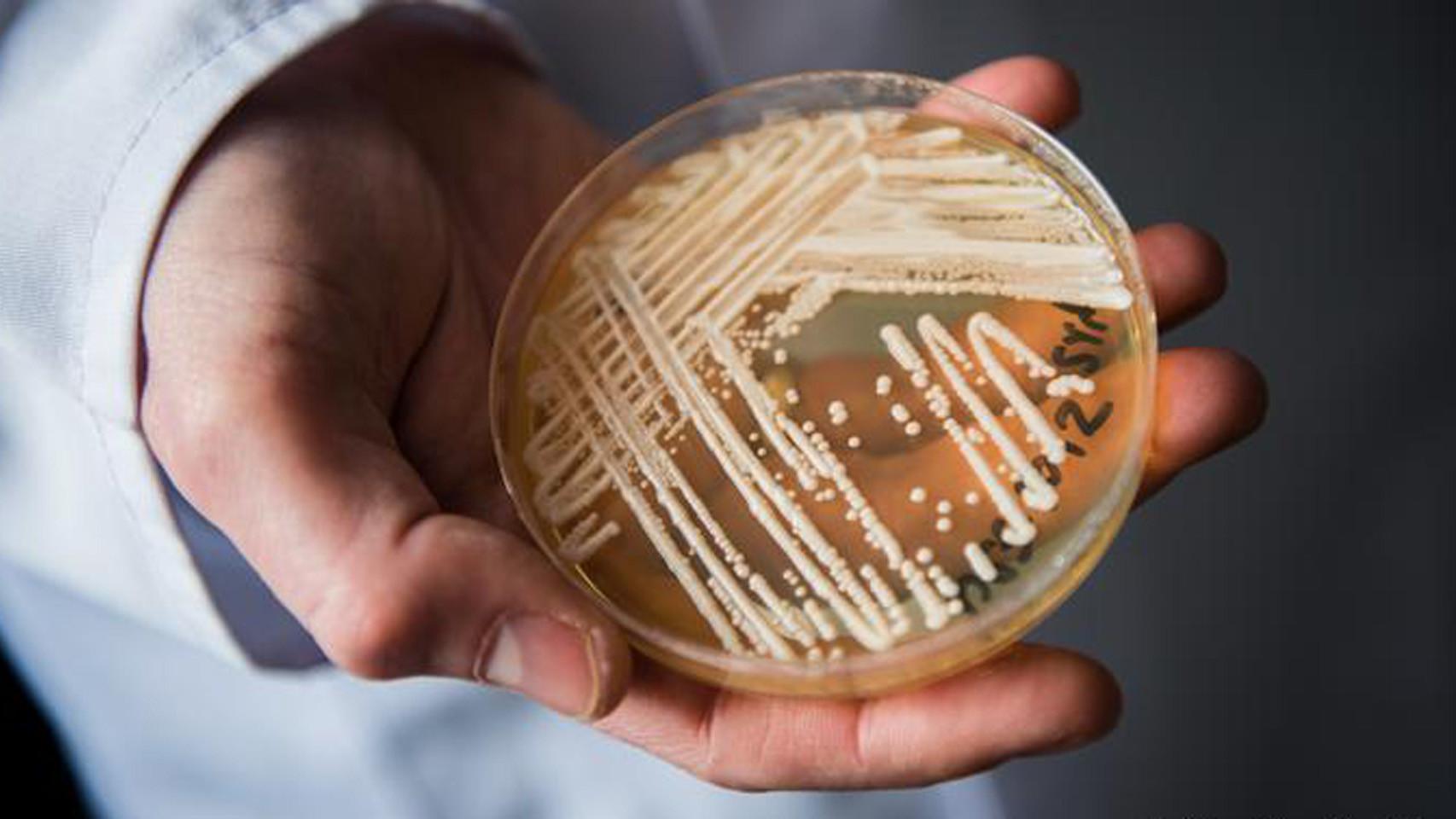 Una cepa de Candida auris cultivada en una placa de Petri.