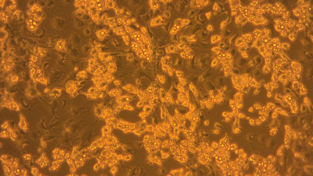 Adipocitos o células grasas.