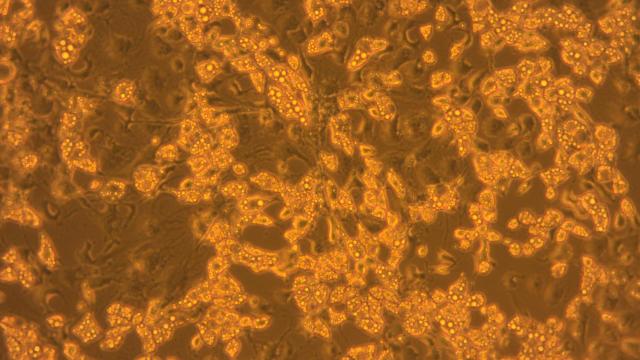 Adipocitos o células grasas.