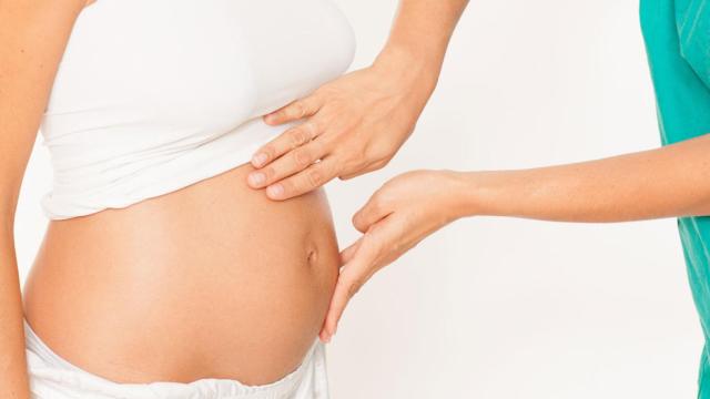 Diastasis abdominal postparto.