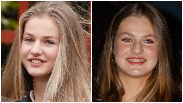 La princesa de Asturias en abril de 2022, sin caninos, y en abril 2023 con ortodoncia.