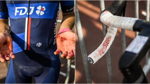 Un corredor del Groupaja FDJ con las manos llenas de heridas tras la Paris-Roubaix
