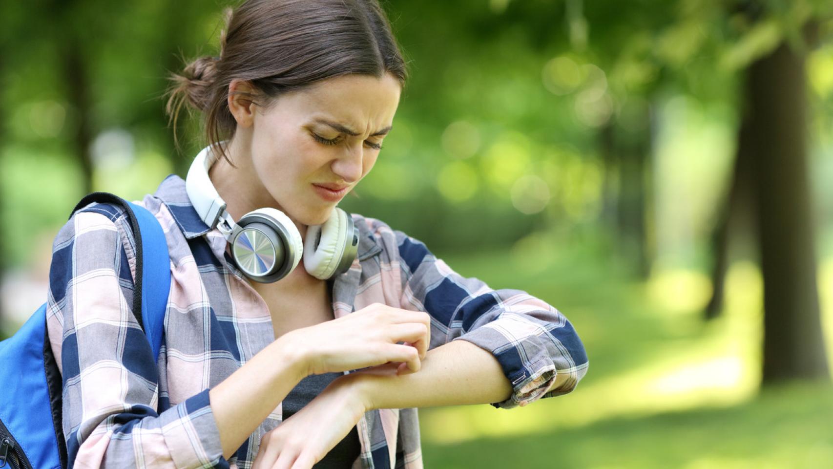 Mujer alérgico rascándose el brazo en un parque.