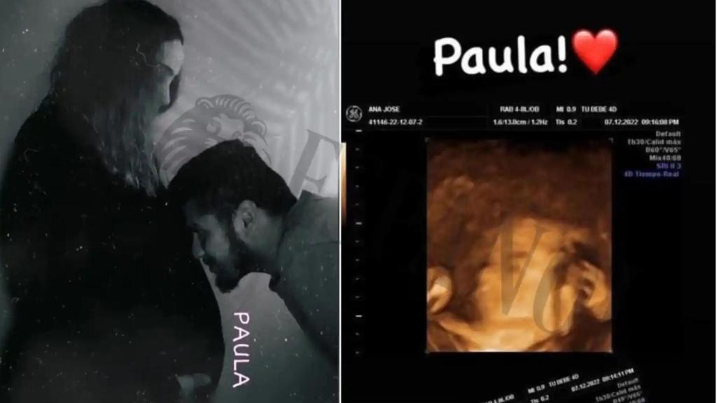 Nacho, besando la tripita de Ana. Al lado, una de las ecografías de Paula, la hija que han perdido tras una cesárea de urgencia en el Hospital Virgen del Castillo de Yecla.