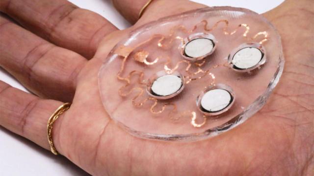 Parche de ultrasonido