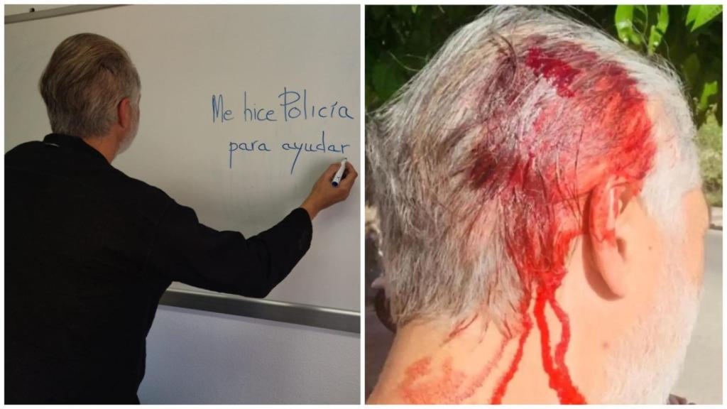 El subinspector de la Policía Nacional que recibió un hachazo estando fuera de servicio, por auxiliar a una mujer que había sufrido un robo, durante la entrevista con este diario.