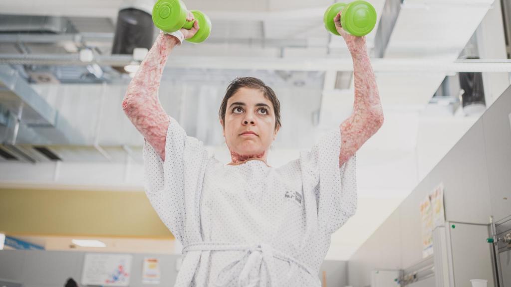 Ryma levanta pesas en su sesión de rehabilitación.