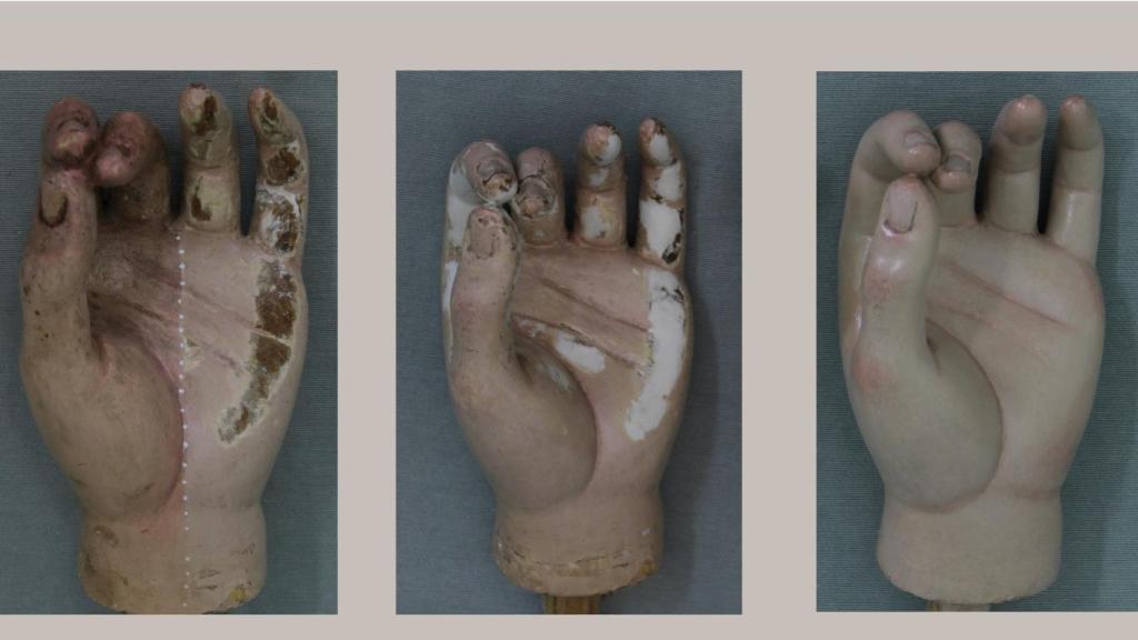 Proceso de restauración de la mano izquierda.