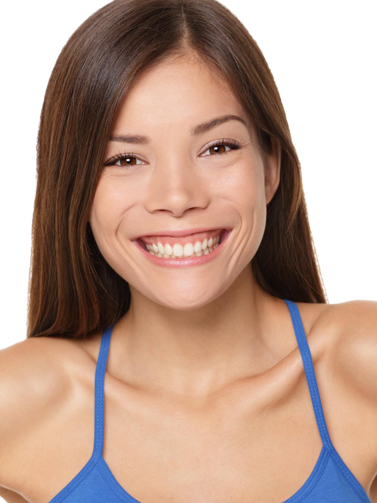 Sonrisa gingival (istock)