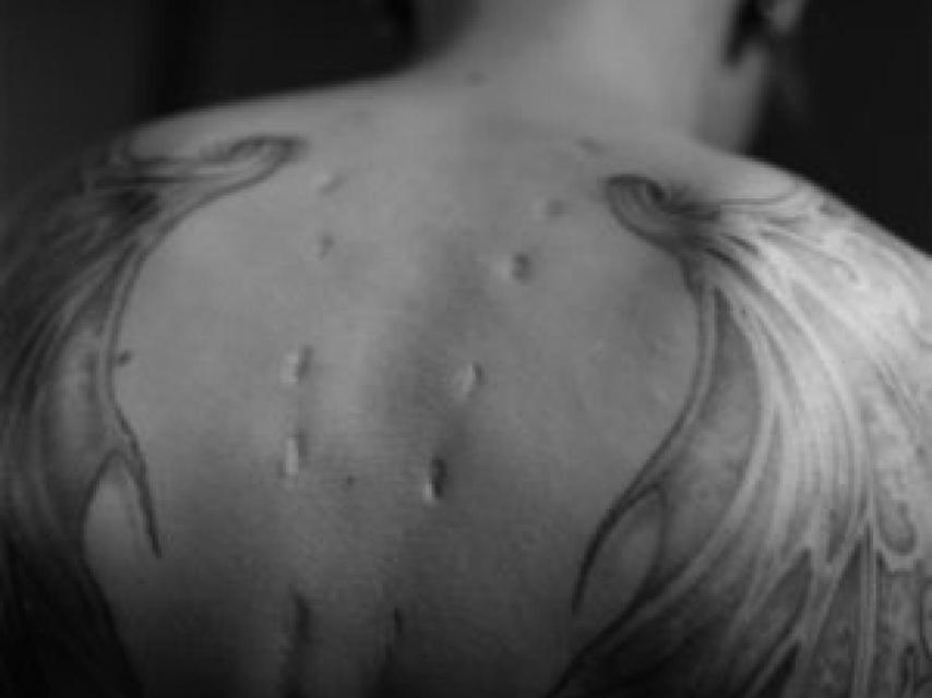 Cicatrices en un ángel, una fotografía de García Alix.