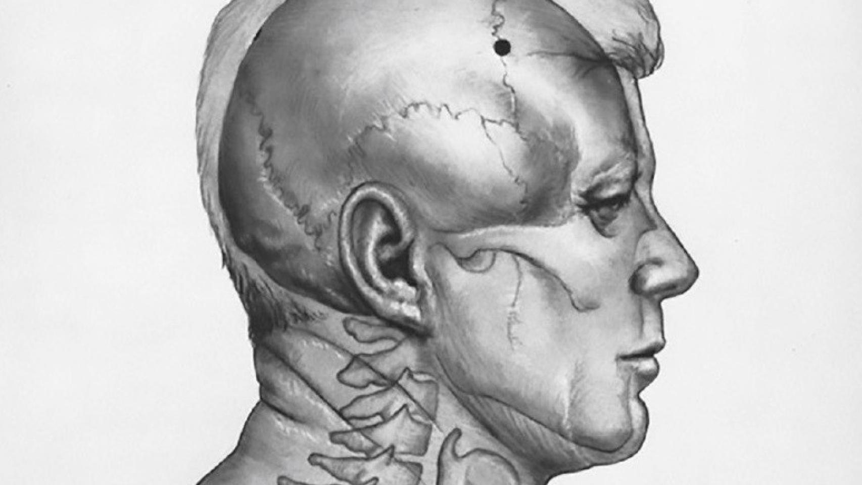 Boceto de la investigación del asesinato de Kennedy. De 'El arte del bisturí' (Salamandra).