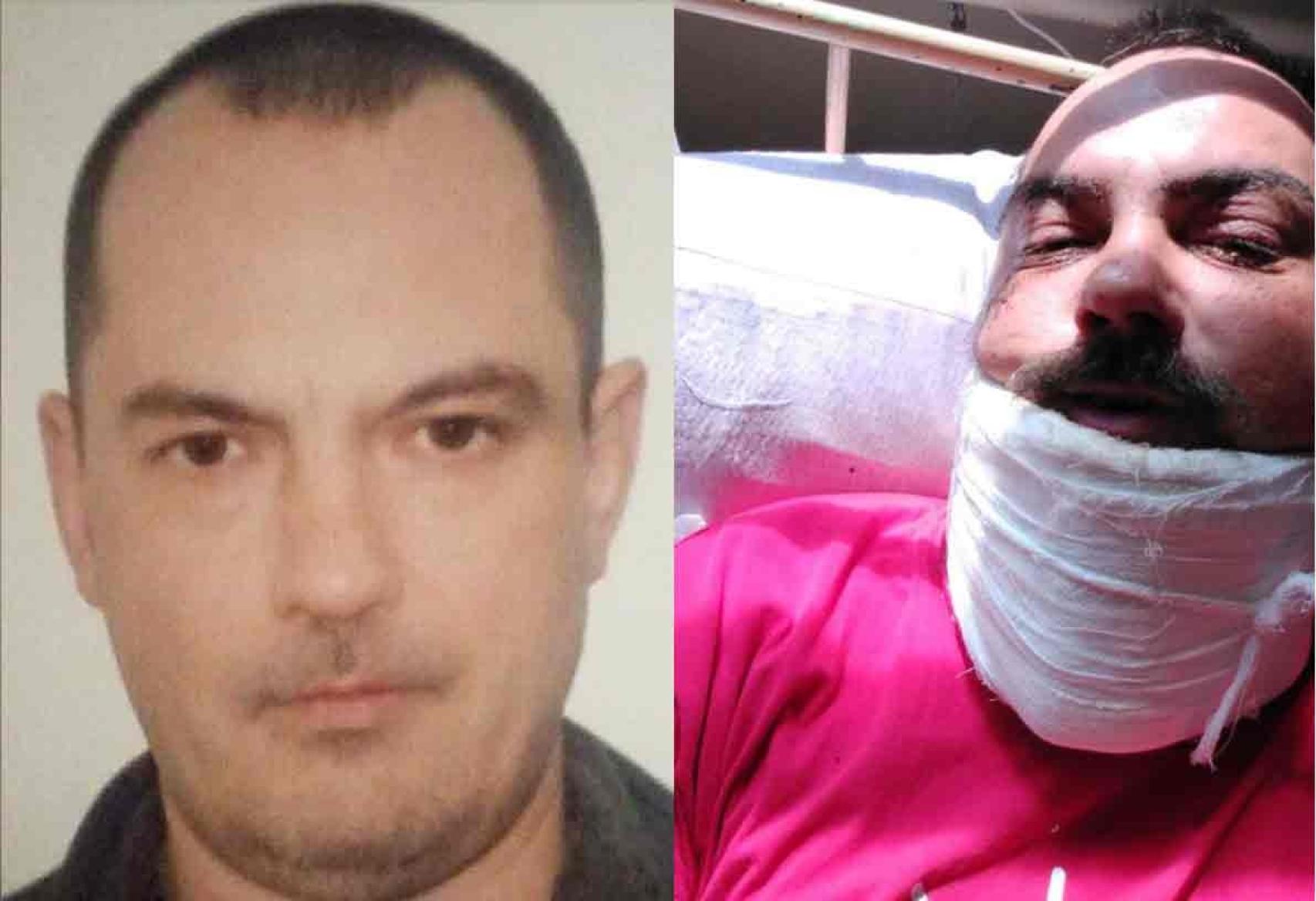 El soldado ruso Zaruyar Tetragrammaton Ar-Rajim antes y después de ser salvajemente agredido por miembros de Wagner en las cercanías de Bajmut.
