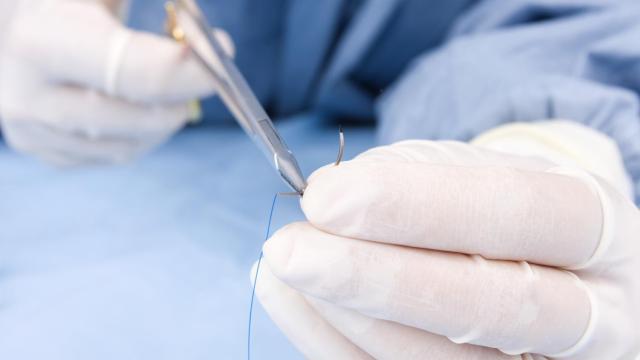 Sutura quirúrgica