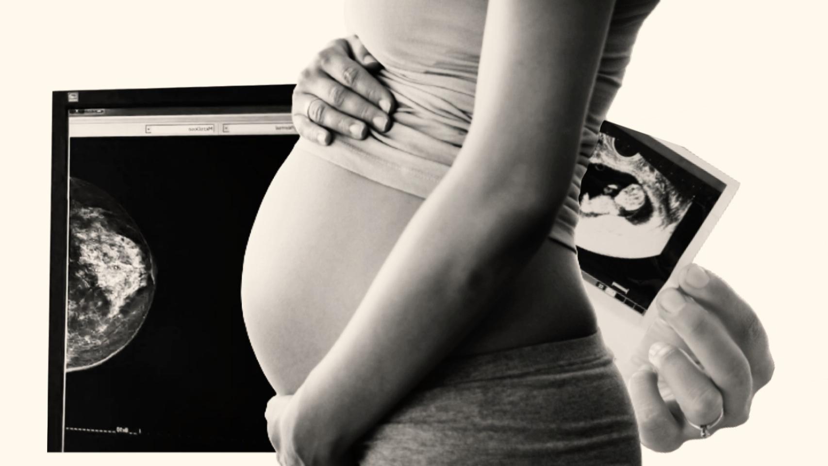 Sólo un 10% de las mujeres logra quedarse embarazada tras el cáncer de mama.