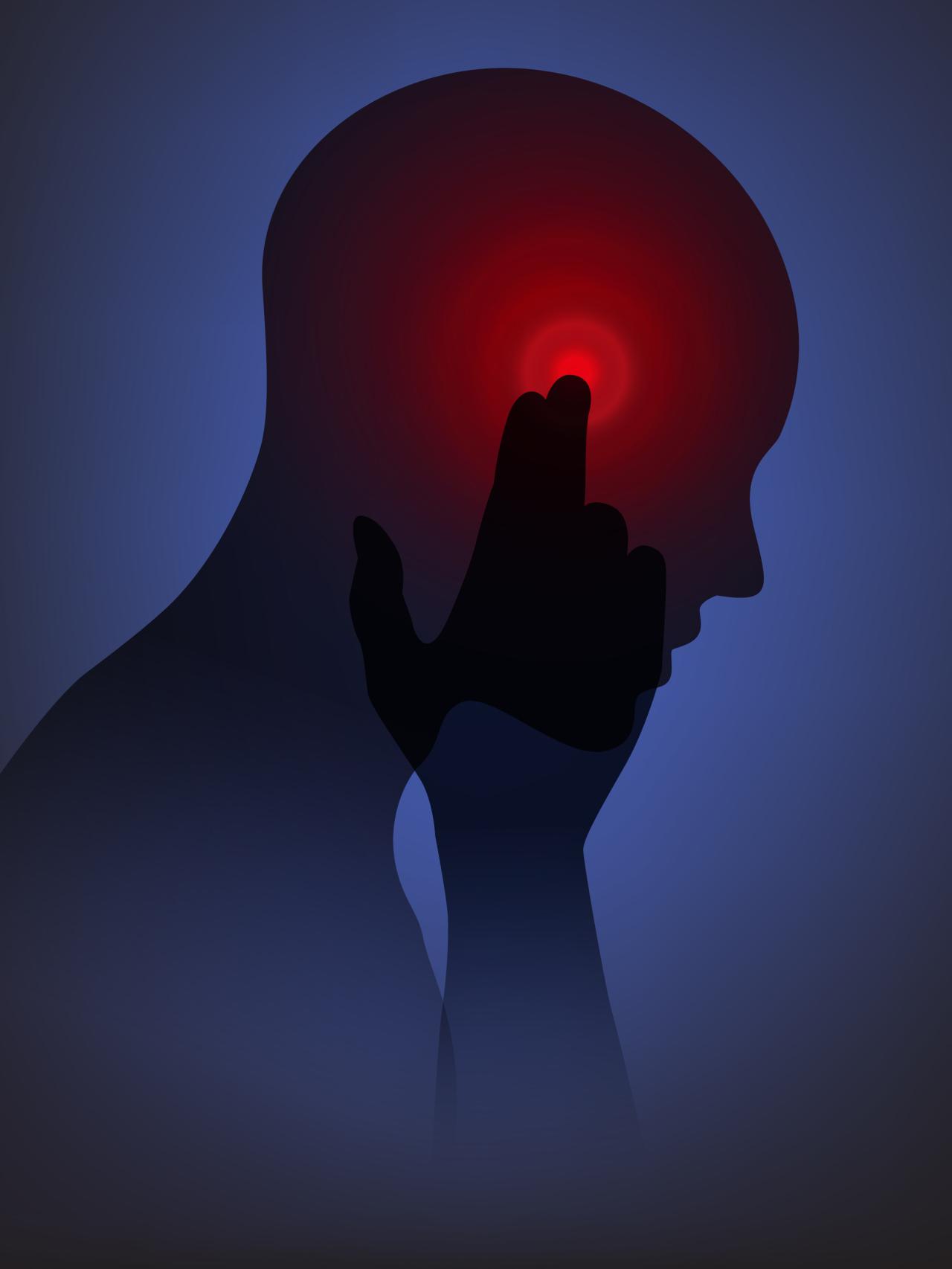 Ilustración del dolor de migraña