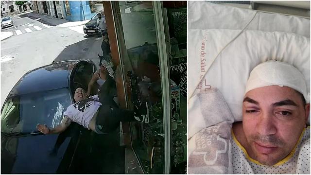 Germán Aragón, en un fotograma del vídeo que recogió su atropello, junto a una imagen suya tras ingresar en el Hospital Morales Meseguer de Murcia.