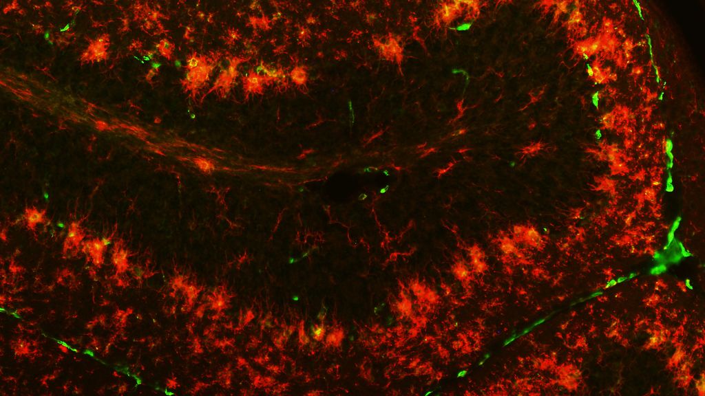 Inmuno fluorescencia microglía en el cerebelo del ratón PCD tratado con OEA