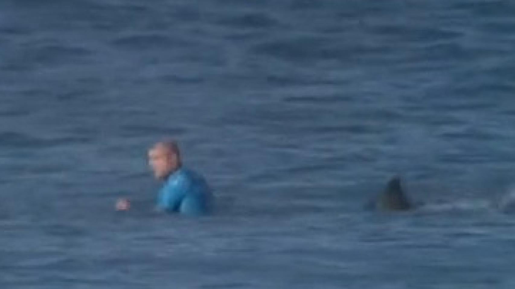 El surfista atacado por el tiburón.