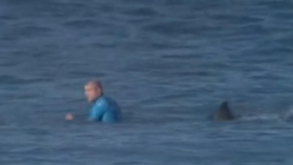 El surfista atacado por el tiburón.
